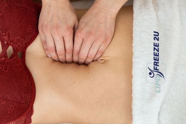diastasis recti treatment Horley
