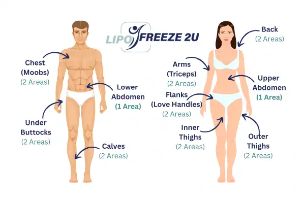 Areas you can have fat freezing treatment Horley