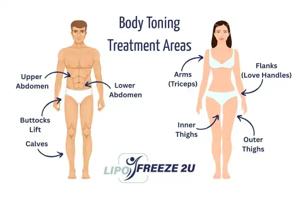Graphic showing where you can have Body toning Treatment Horley on your body
