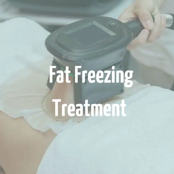 fat freezing treatment Horley
