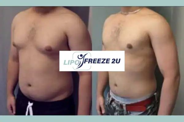 How Long Does It Take to See Results Horley?