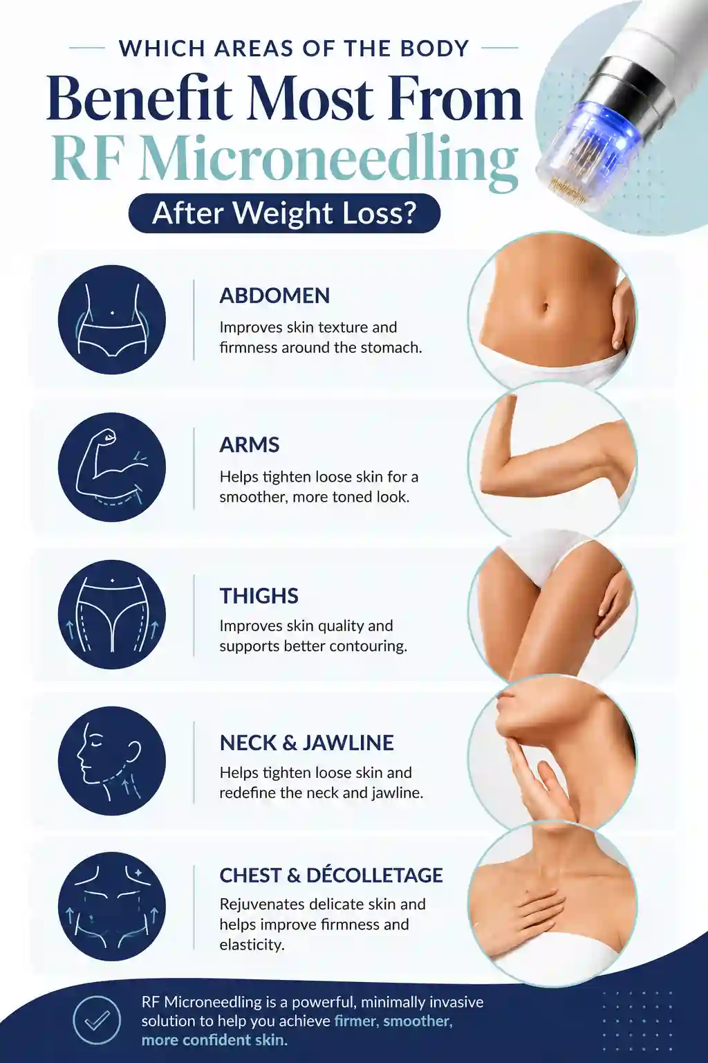 Which Areas of the Body Benefit Most From RF Microneedling After Weight Loss Horley